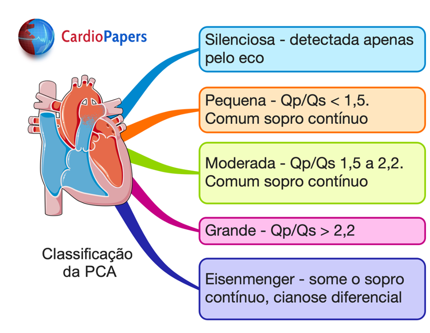 Persistência do canal arterial PCA o que eu tenho que saber CardioPapers